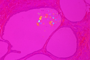 Flickr-Mammogram-euthman